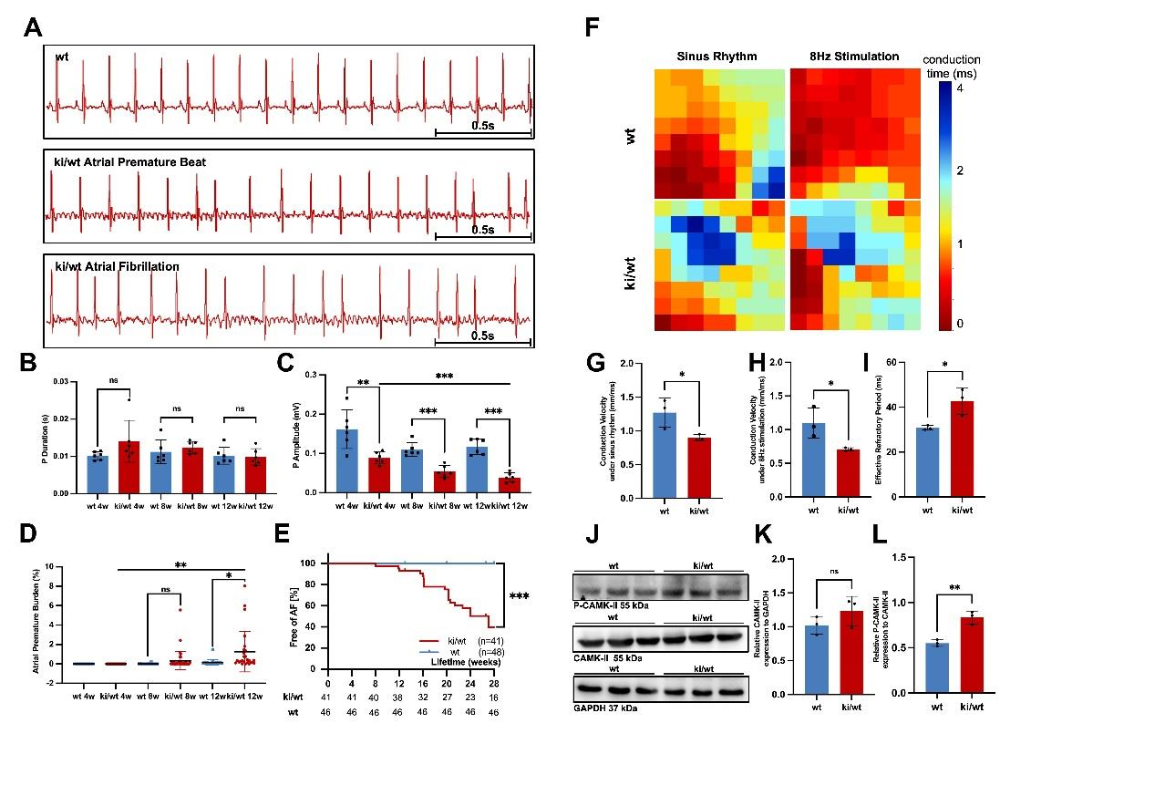 一种新的自发性房颤心肌病模型: 通过CRISPR/Cas9在小鼠体内心脏特异性过表达CREM-IbAC-X 斯高电生理研究院